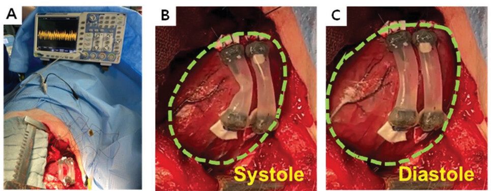 Figures from a paper showing a pig on a surgical table, and a cylindrical device attached to its heart stretching and relaxing