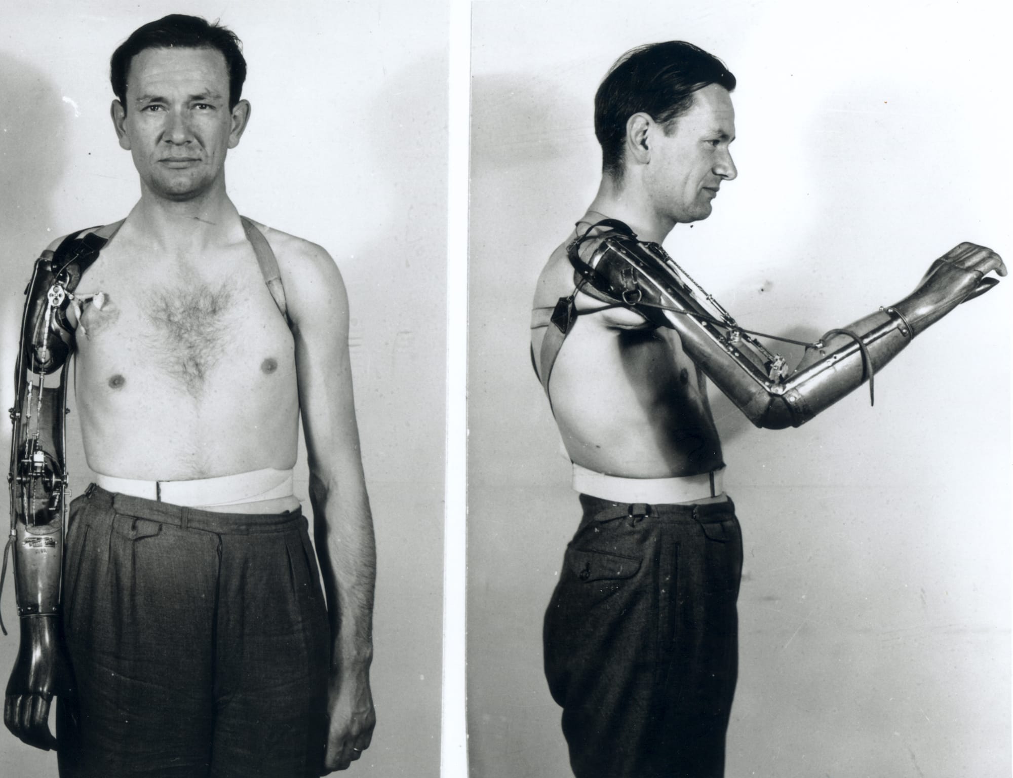A man with a metallic right arm