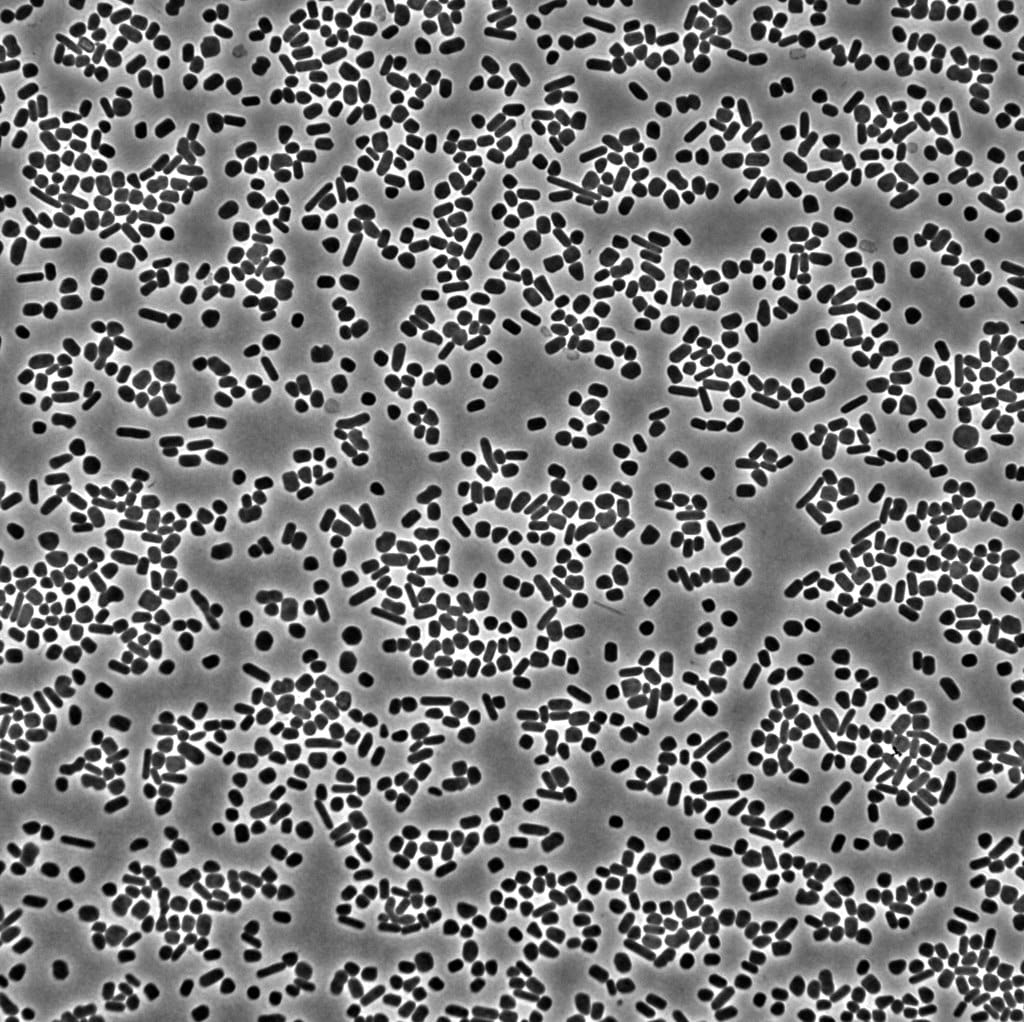 Bacteria growing under a microscope